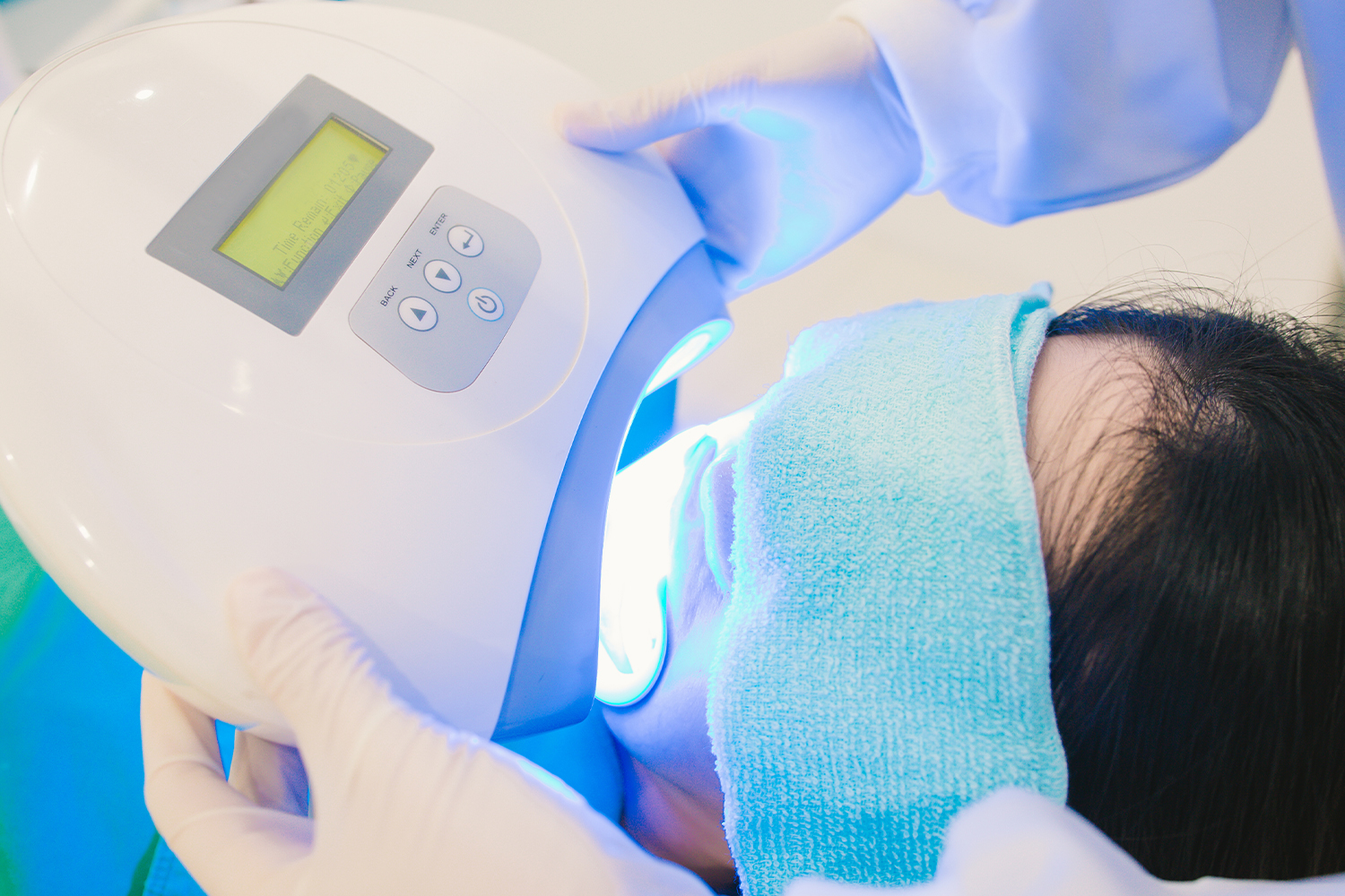 ホワイトニング